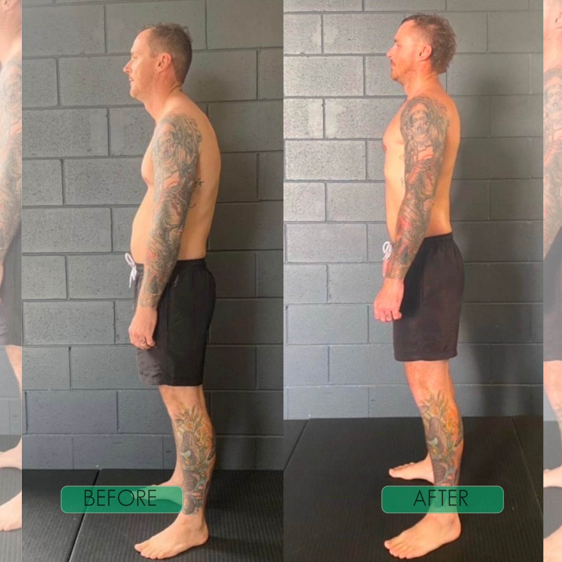 Instant Posture Corrector